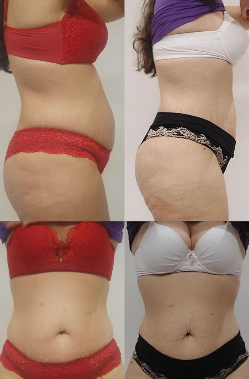 Transformação de Lilian - Antes e Depois