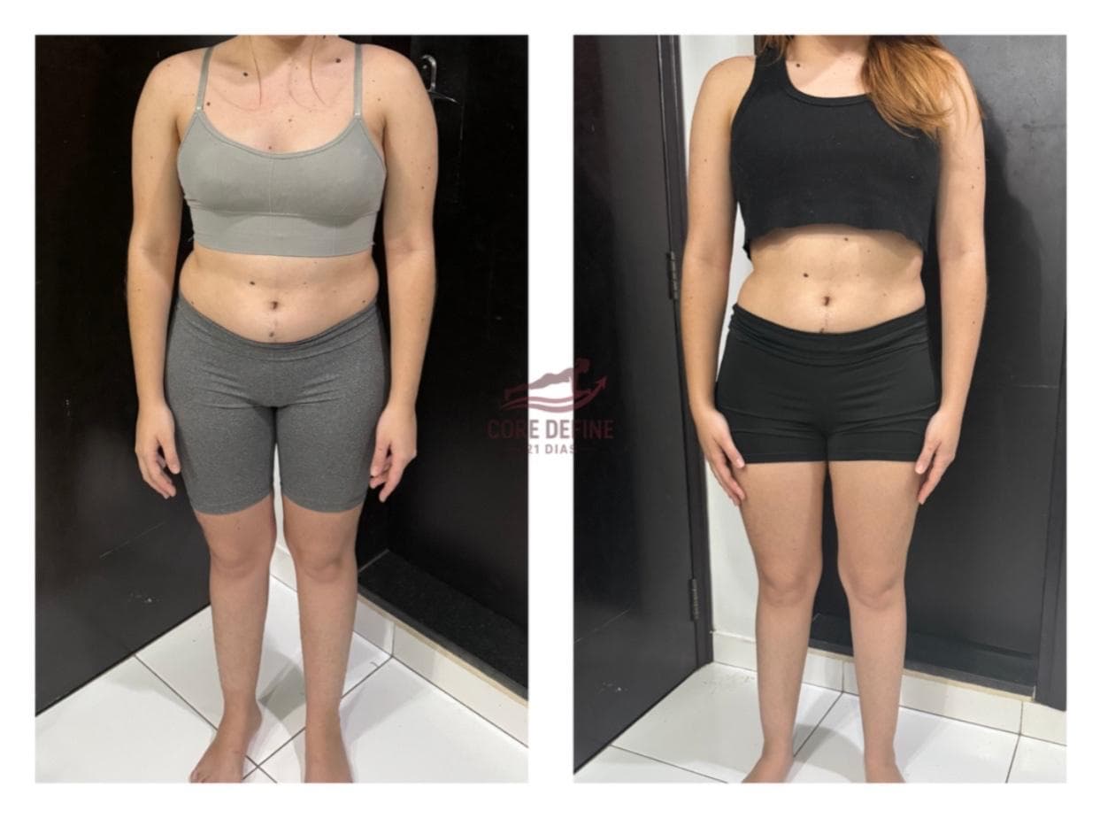 Transformação de Kauane - Antes e Depois