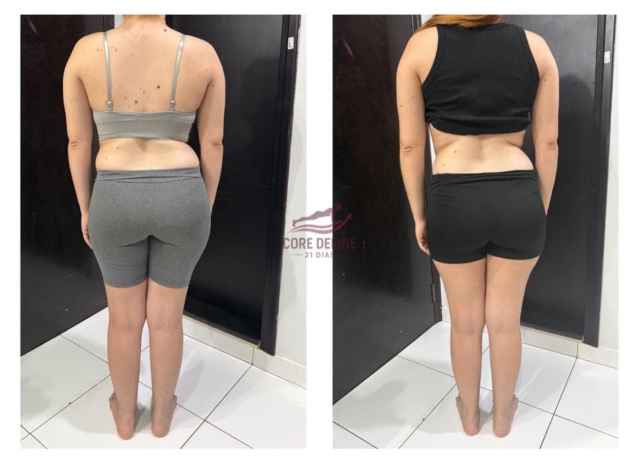 Transformação de Kauane - Antes e Depois