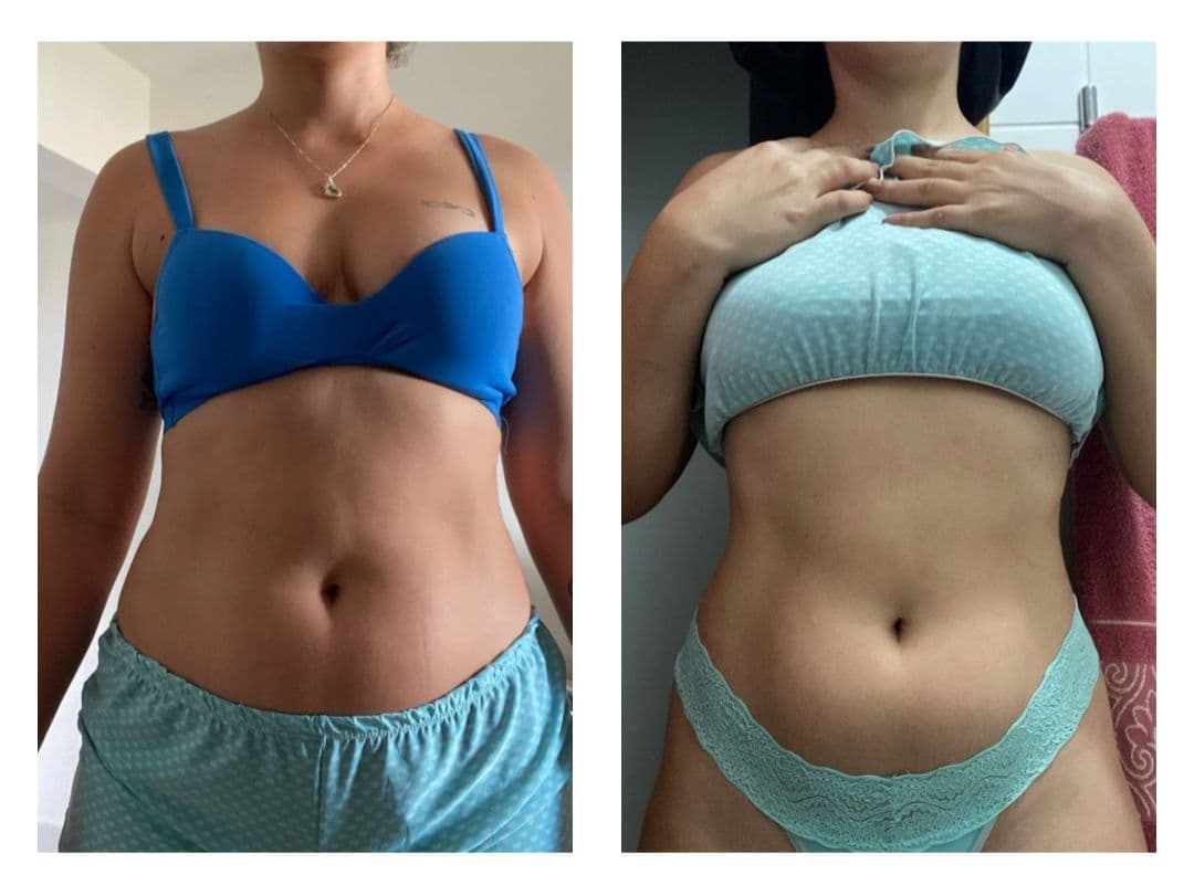 Transformação de Geovanna - Antes e Depois