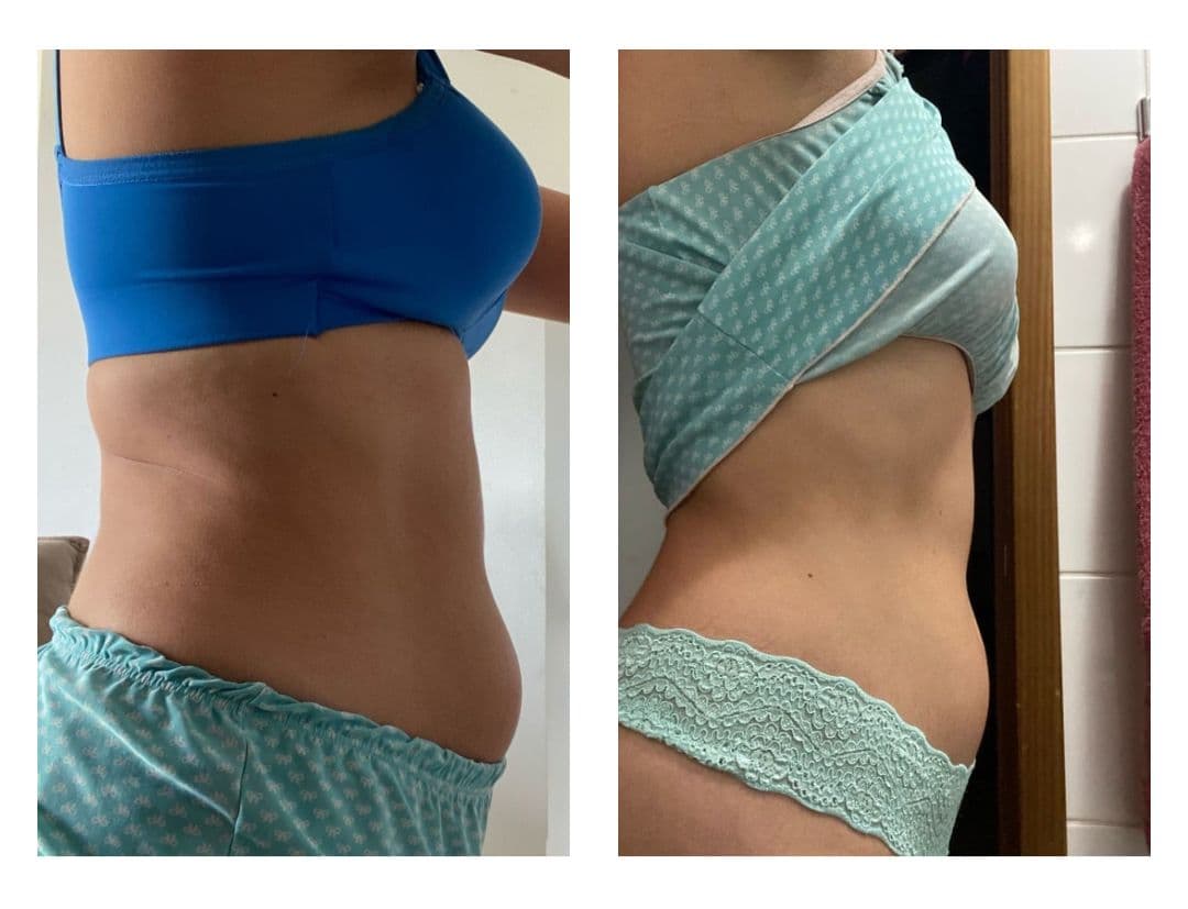 Transformação de Geovanna - Antes e Depois